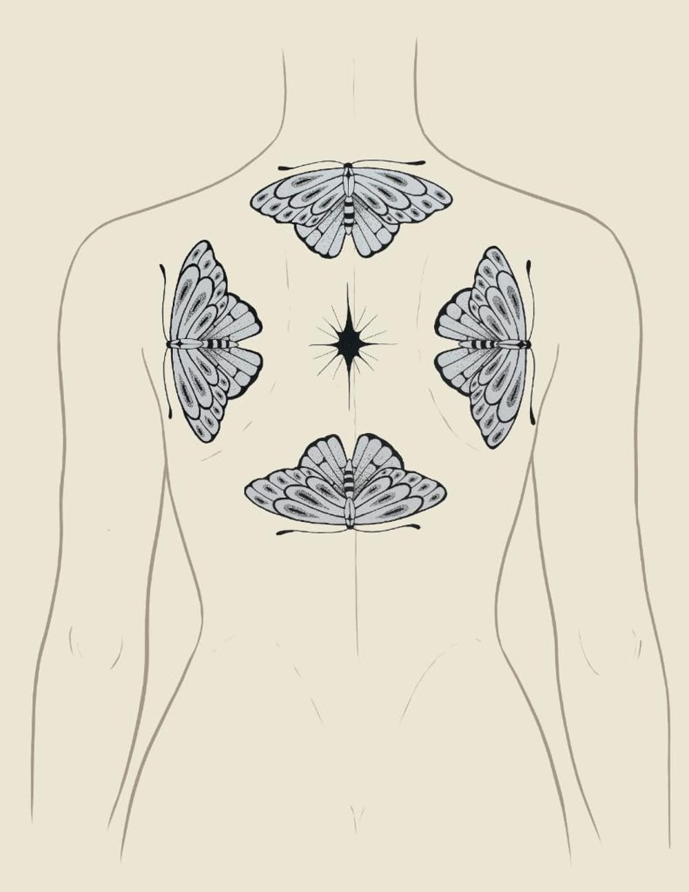 Butterfly Radial