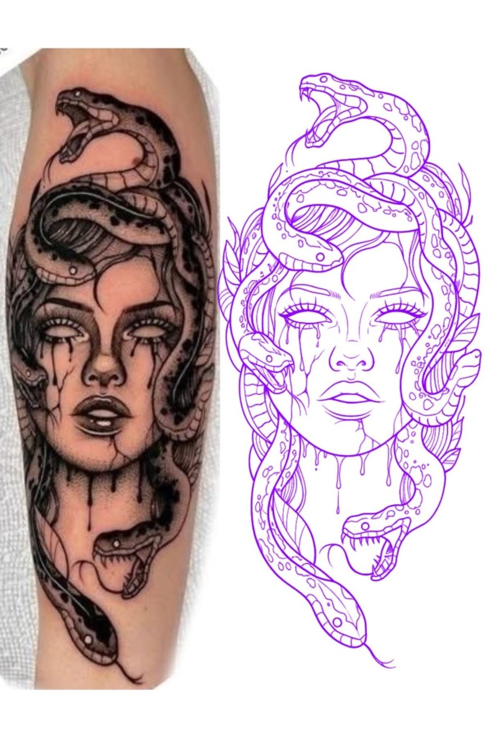 Medusa head 