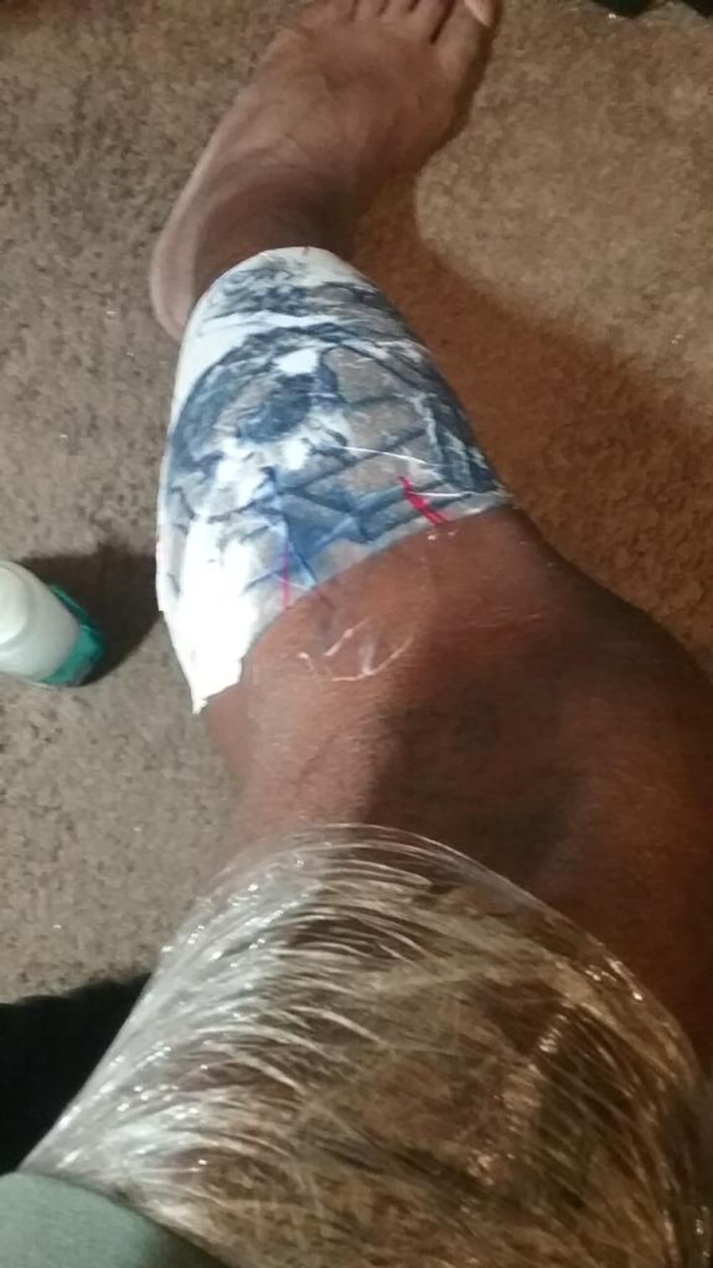 Leg sleeve