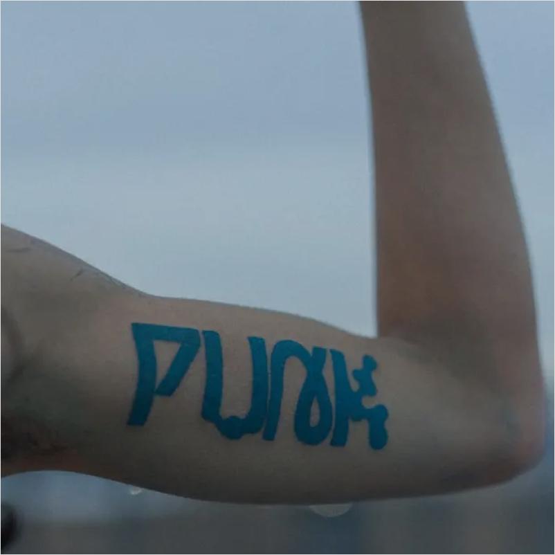 Upper Arm photo
