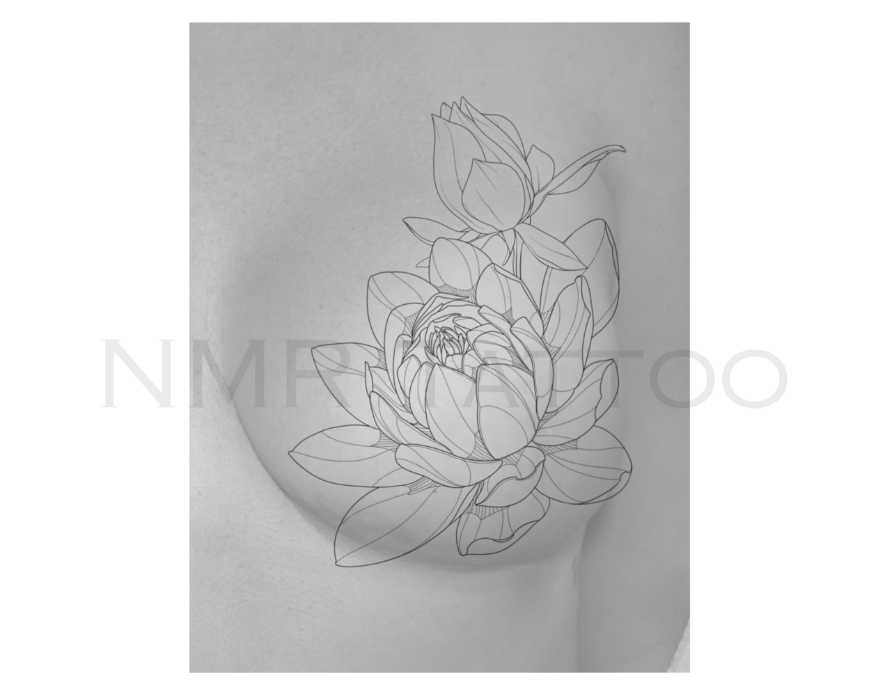 Lotus Unilateral
