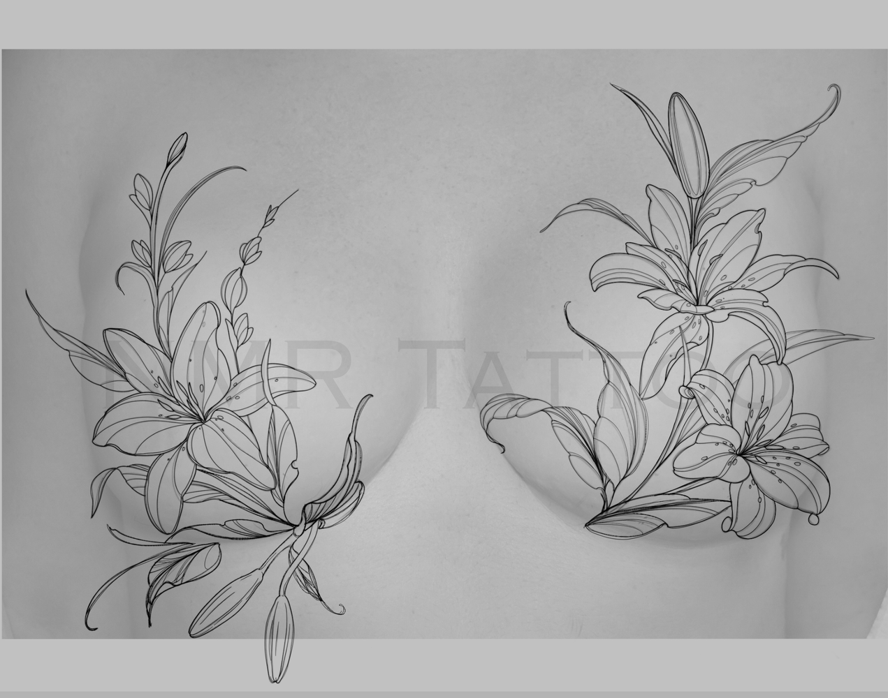 Lilly Bouquet Mastectomy Coverup